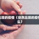突然出现的疫情（突然出现的疫情叫什么）
