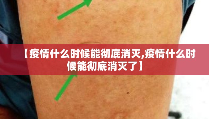 【疫情什么时候能彻底消灭,疫情什么时候能彻底消灭了】