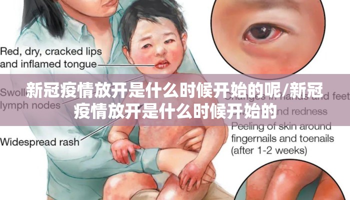 新冠疫情放开是什么时候开始的呢/新冠疫情放开是什么时候开始的