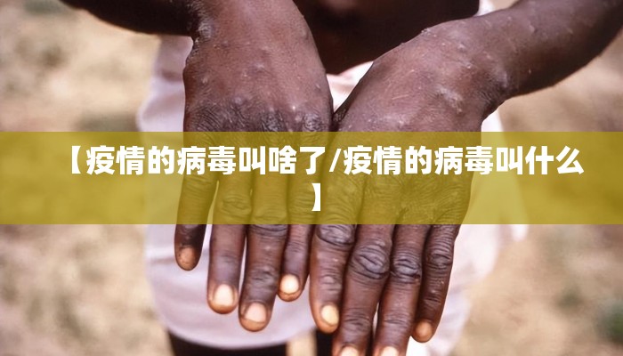 【疫情的病毒叫啥了/疫情的病毒叫什么】
